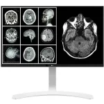 LG 27" 8MP Monitor Clínico de Revisión 27HJ713C-B